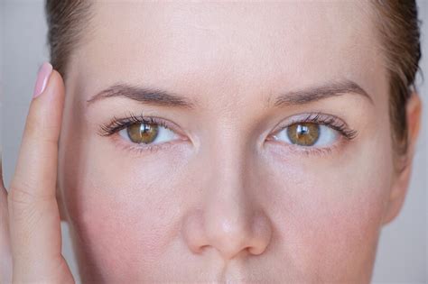 Droopy Eyelid After Botox Why It Happens And How To Fix It