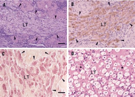 Corpus Luteum Histology Labeled