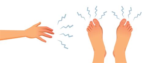 Dormências Nas Mãos E Pés - Vetores de Dormência Nas Extremidades Para Pés E Mãos Ilustração Do ...