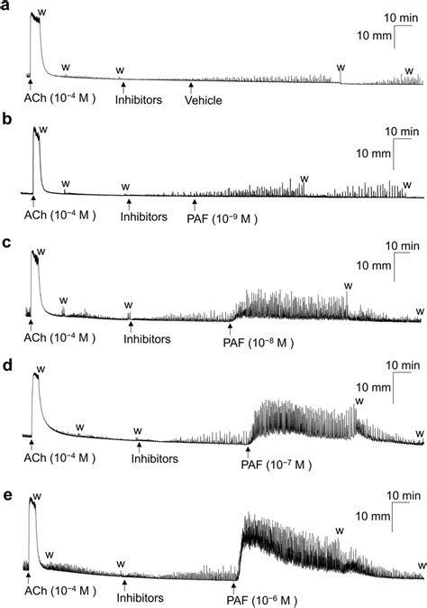 Representative Traces Showing The Contractile Response Of Acetylcholine Download Scientific