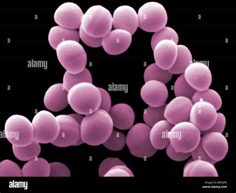 Staphylococcus epidermidis es un miembro común de la piel y las membranas mucosas Fotografía de ...