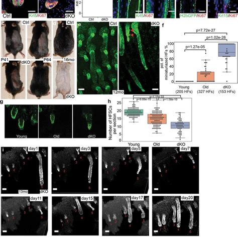 Hair Follicle Miniaturization And Loss In Dko Mice A Krt And Ki