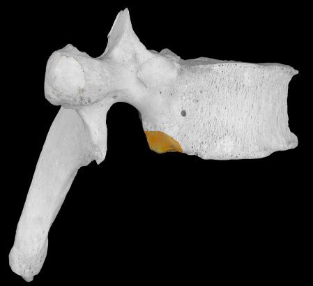 thoracic vertebrae landmarks Flashcards | Quizlet