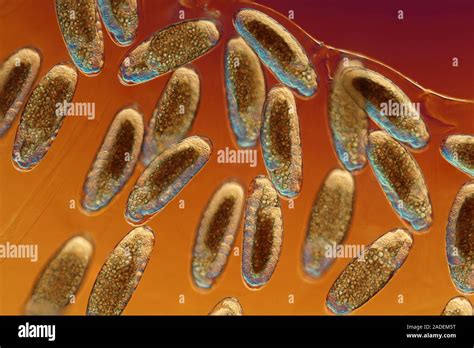 Los huevos de mosca micrografía de luz Estos huevos han sido