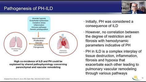 Revised Definition Of Pulmonary Hypertension And Approach