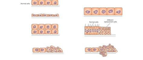 Patho Intro Cell Tissue Alterations Diagram Quizlet