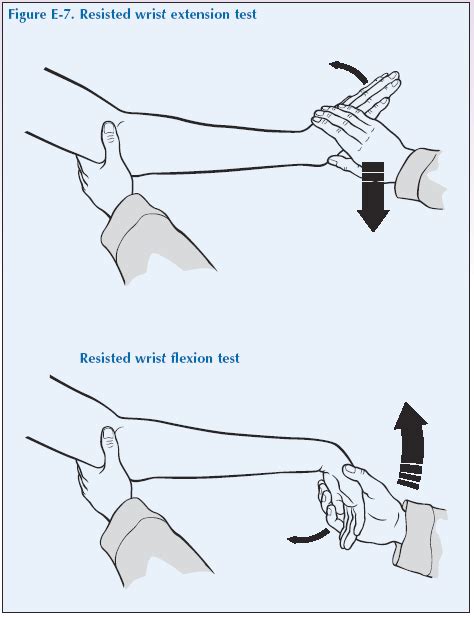 Global Alliance For Musculoskeletal Health E7 Resisted Wrist Extension Test