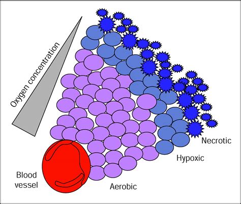 The Role Of Hypoxia Activated Prodrugs In Cancer Therapy The Lancet