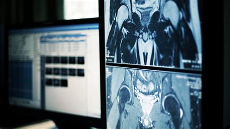 Perbedaan X Ray Ct Scan Dan Mri Dalam Pencitraan Medis Info Kesehatan