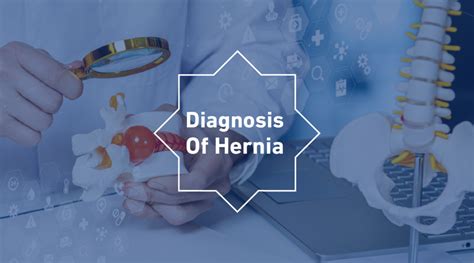 Diagnosis of Hernia - Dr. Abdulrahman Al-Mishari Hospital