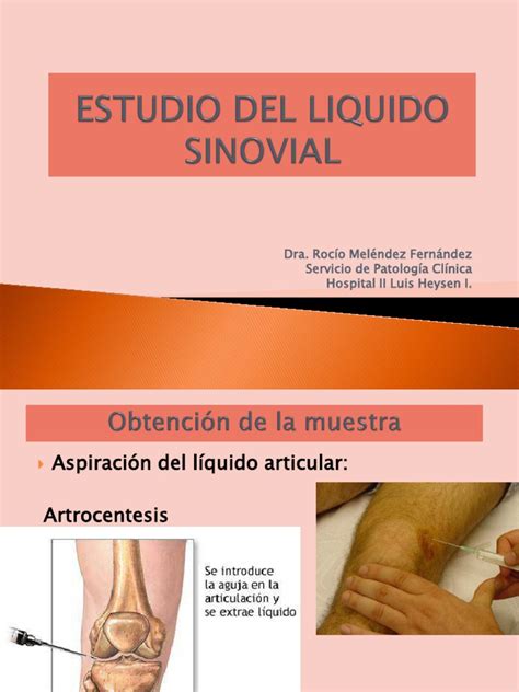 9 LIQUIDO SINOVIAL | Lactato deshidrogenasa | Inflamación