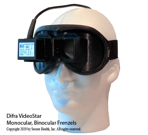 Frenzel - Monocular, Binocular Video Frenzel - Premium VNG Technology