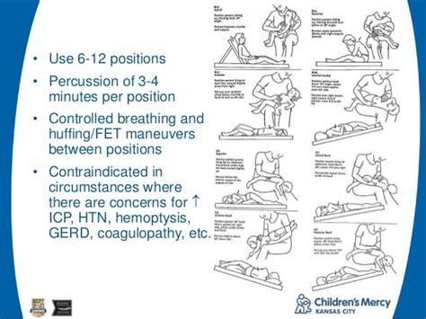 Assisted Airway Clearance In Pediatric Respiratory Disease