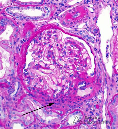 Juxtaglomerular Apparatus Histology