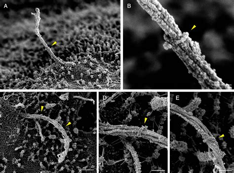 Scanning Electron Microscopy Of Human Islet Cilia Pnas