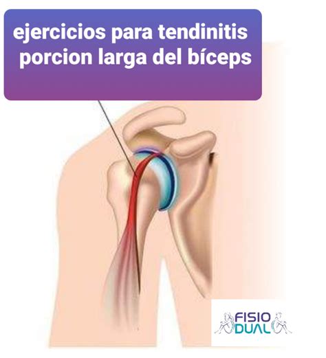 Tendinitis de la porción larga del bíceps FisioDual Fisioterapia y