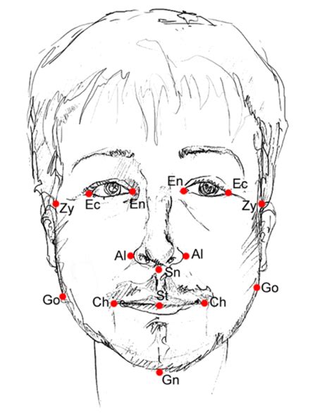 Diagram Depicting Facial Landmarks Used For Photo Anthropometry