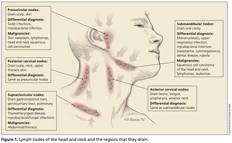 Epitrochlear Nodes