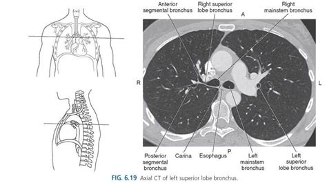 Thorax Sectional Anatomy For Imaging Professionals 4th Edition