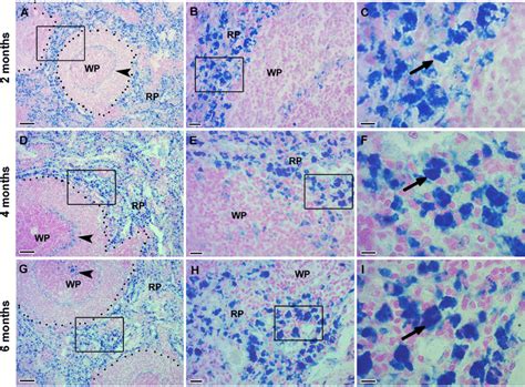 Photomicrographs Of Spleen Sections Stained With Prussian Blue And