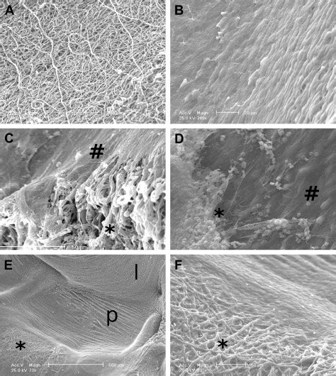 Porcine Carotid Artery Replacement With Biodegradable Electrospun Poly