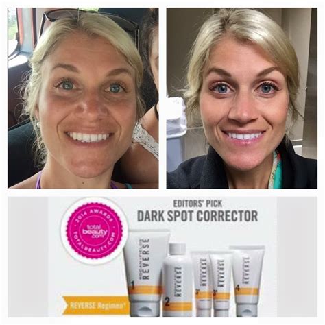 rodan fields real people real results motherhood support