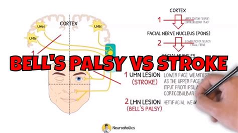 Bells Palsy Anatomy