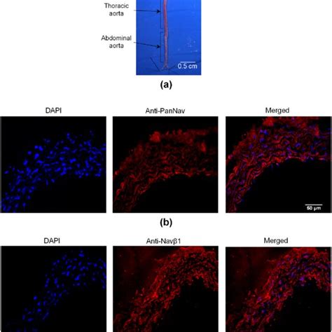 Immunolocalization Of Nav Channels In Mouse Aorta A The Image