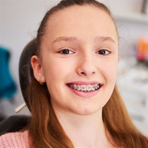 Braces For Kids In The Woodlands Auburn Lakes Orthodontics