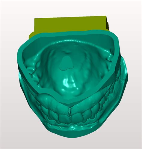 Stl File Tooth Model High Low Articulated 🦷・3d Printer Model To Download・cults