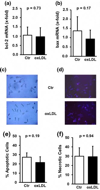 Effect Of Oxldl On Cell Viability Serum Free Cultured Adult Rat