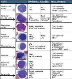 17 Hematology Slides ideas | hematology, medical lab technician ...