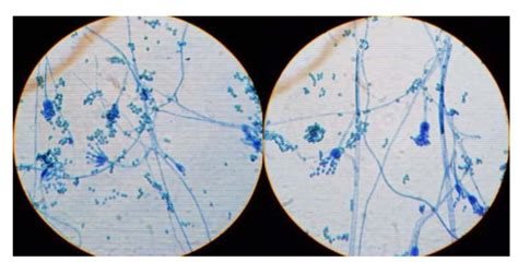 Hongos Penicillium