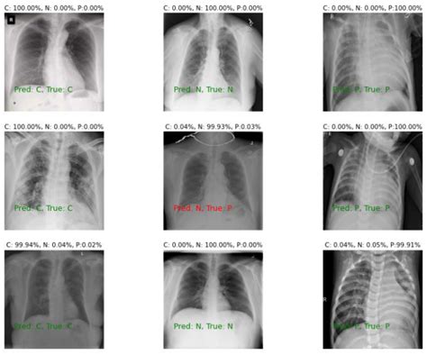 Sensors Free Full Text Covidx Lwnet A Lightweight Network Ensemble