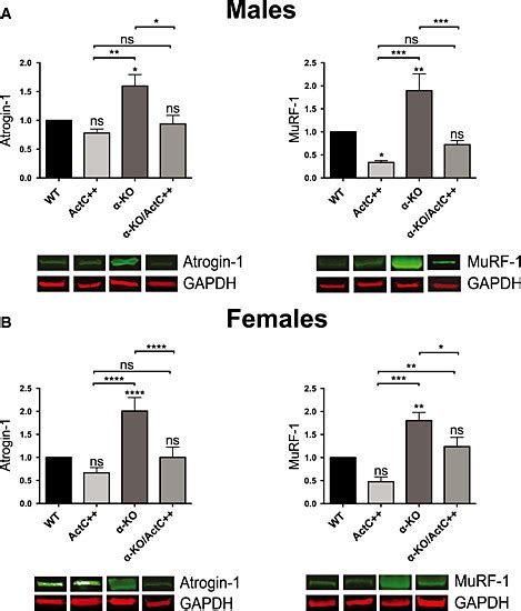 Activin βC overexpression attenuates Atrogin 1 and MuRF 1 levels in the