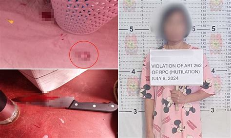 Furious Wife Hacks Off Her Husband S Penis After He Said Another Woman S Name During Sex