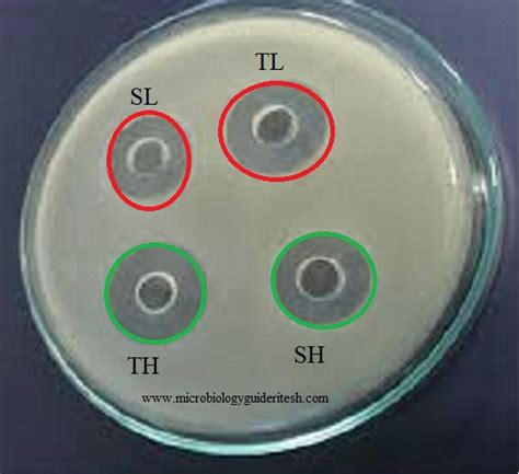 Microbial Assay Antibiotic Assay Microbiology Guidelines