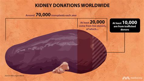 Kidney For Sale Inside Philippines Illegal Organ Trade Cna