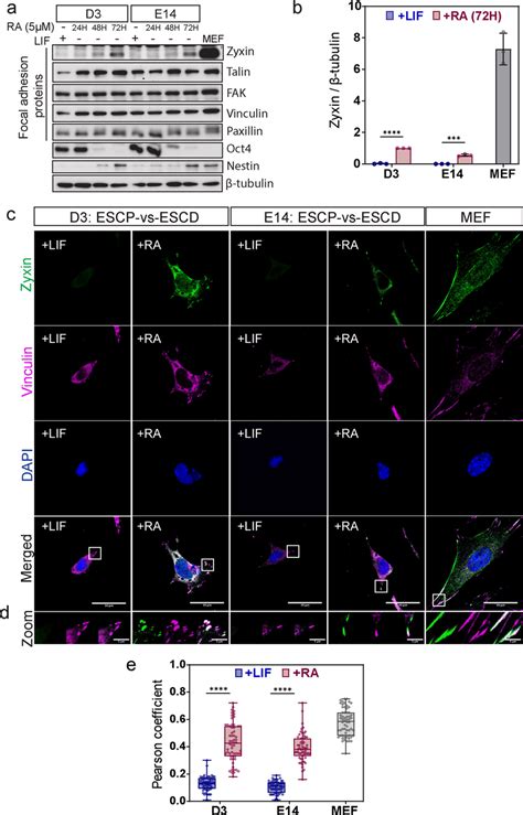 Zyxin Level Is Elevated In The Process Of RA Induced Early