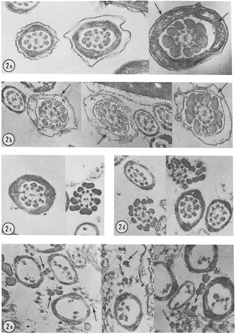 Electron Micrographs Showing Cross Sections Of Bull Sperm Flagella At