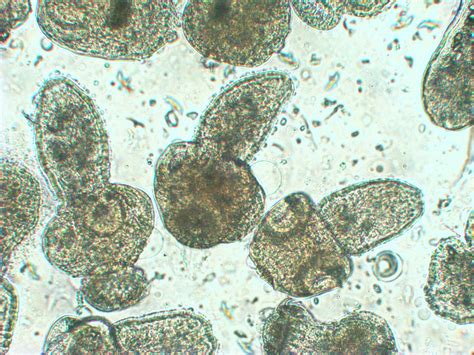 Echinococcus Granulosus Archives Quadratech Diagnostics