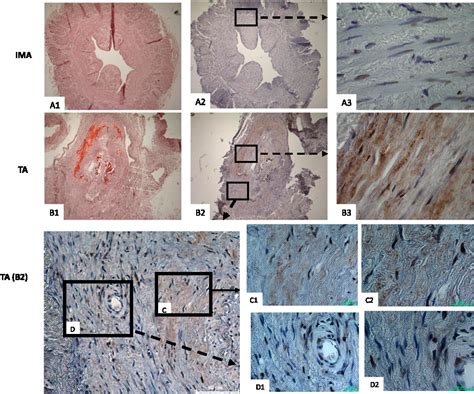 Figure 1 From The RANKL RANK OPG Signaling Pathway Mediates Medial