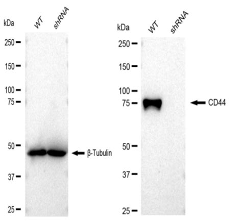 WB Validated CD44 Lentiviral shRNA Knockdown Kit V61350 产品列表 善本生物科技