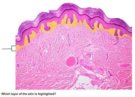 Layers Of The Dermis Papillary And Reticular