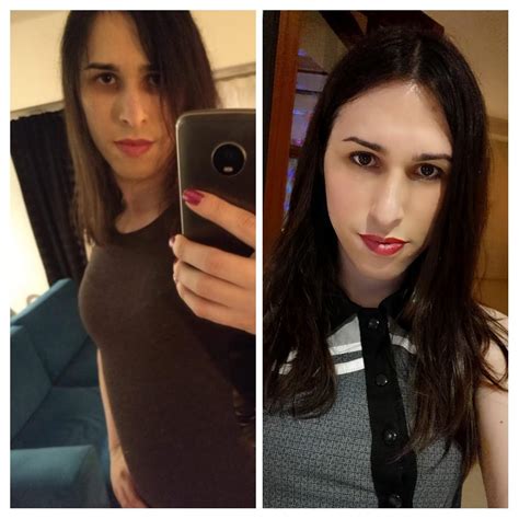 6 Months Vs 3 5 Years On Hrt Srs 2 Months Ago And Still Recovering Better Than Ever R