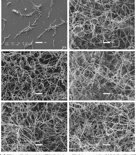 Figure 2 from Characteristics of biofilm formation by Candida ...