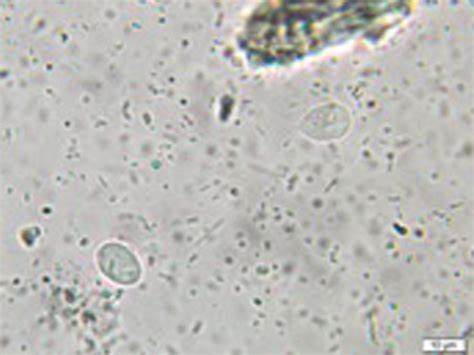 Giardia Lamblia X