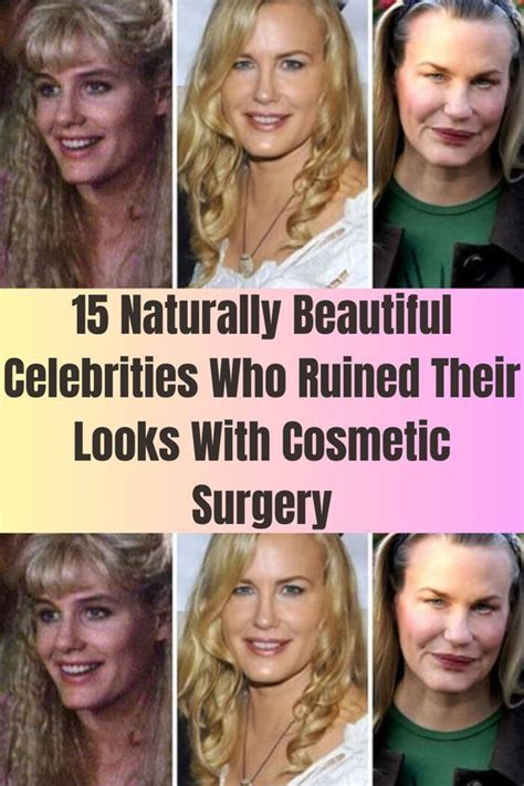 15 naturally beautiful celebrities who ruined their looks with cosmetic ...