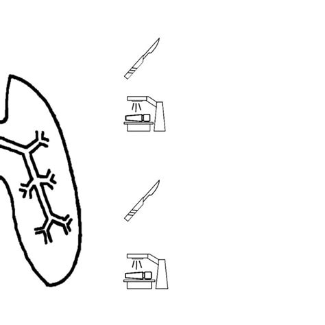 Surgery Or Rt In Nsclc N2 Stage Iii Onkologie Universimed Medizin Im Fokus