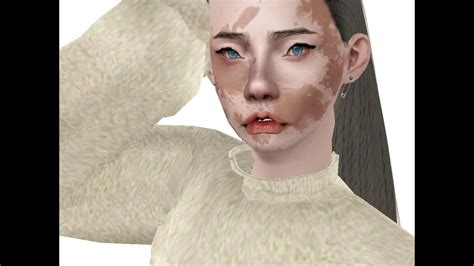 Sims 4 Vitiligo Hands